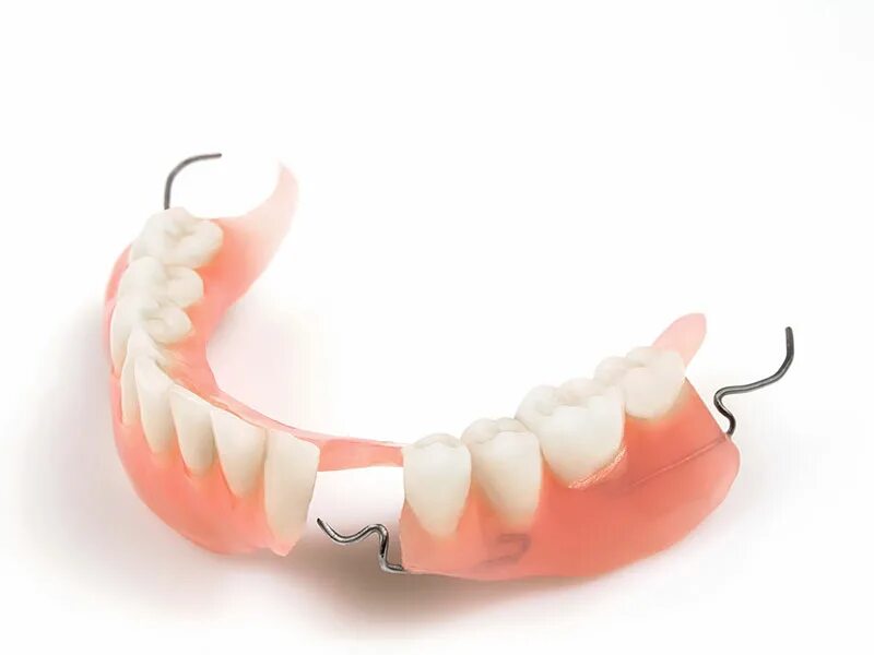 Протезы квадротти без неба. Как называется протез. Частичный съемный протез flexi n512. Как называется протез. Как называется протез.