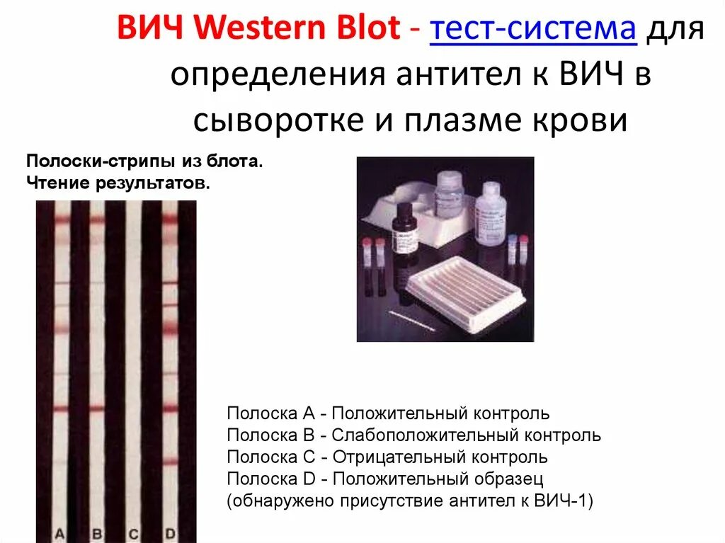 Иммуноблоттинг вестерн Блот. Иммунный блоттинг вич1. ВИЧ вестерн блоттинг. Иммуноблот ВИЧ.