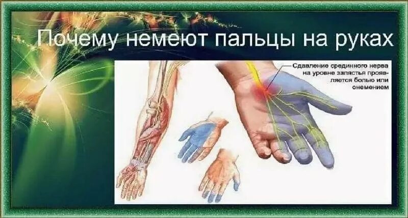 Почему происходит онемение. МНЕМТ пальцы на левой руке. Онемение пальцев левой руки. Немеют пальцы на руках причины.