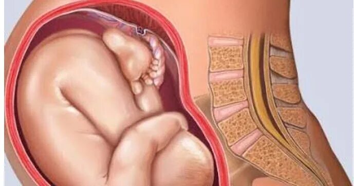 Расположение плода на 37 неделе. Расположение ребенка на 37 неделе беременности. Ребенок в животе на 37 неделе. Тонус на 37 неделе