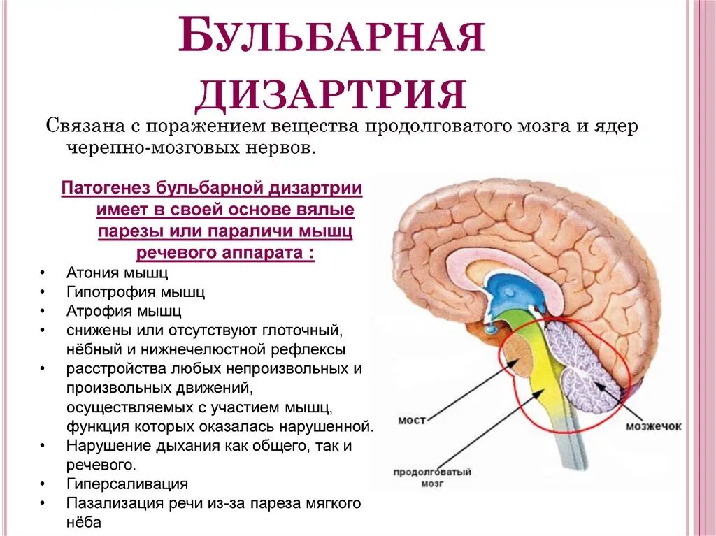 Симптомы нарушения работы отдела головного мозга. Продолговатый мозг и бульбарная дизартрия. Патогенез бульбарной формы дизартрии. Классификация дизартрии по локализации. Речевая симптоматика бульбарной дизартрии.