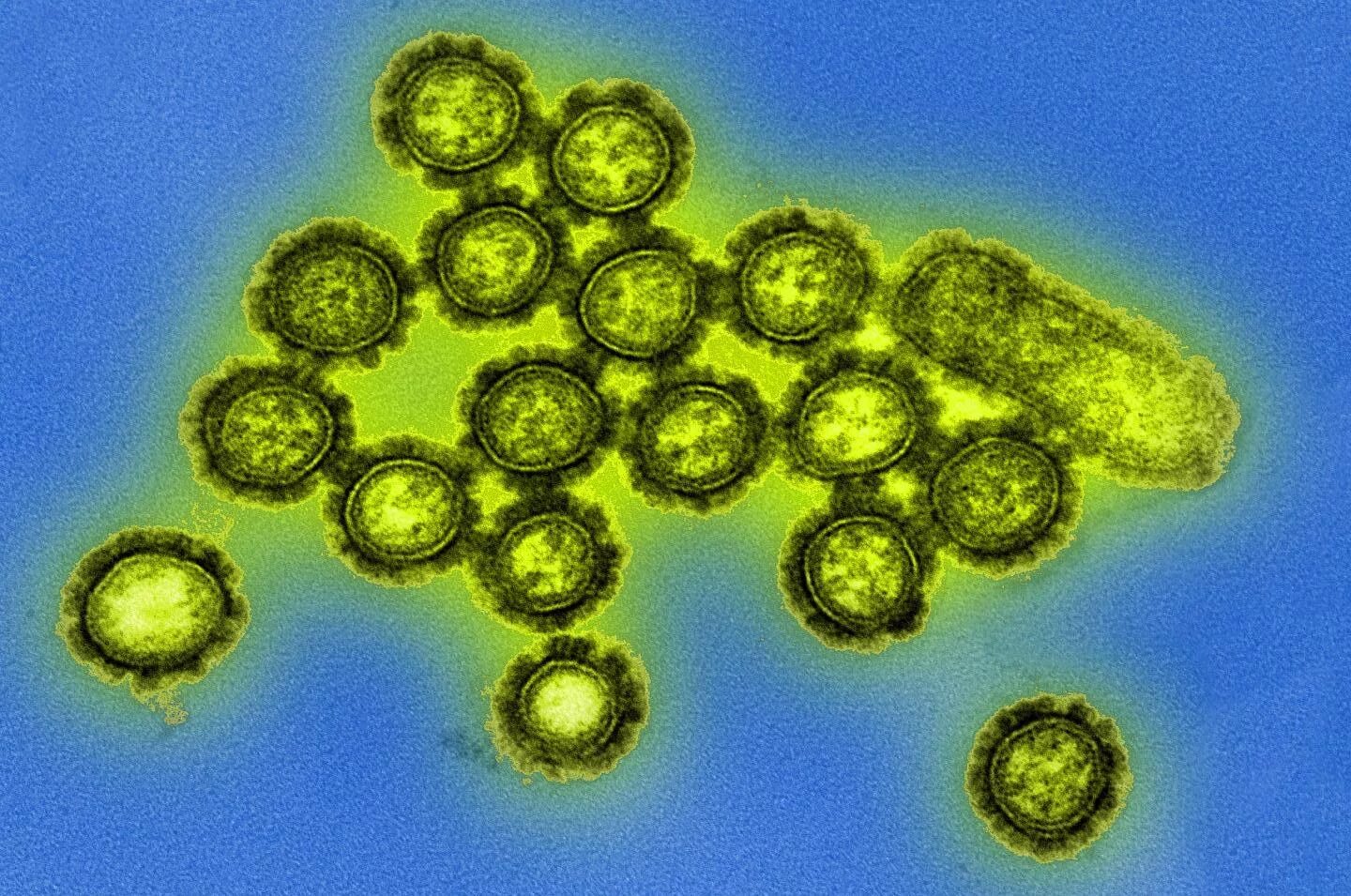 Вирус гриппа под. Вирус гриппа микрофотография. Электронная микрофотография вируса гриппа а. Вирус гриппа под микроскопом h1n1. Вирус свиного гриппа под микроскопом.