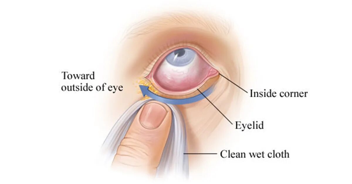 Eye corner. Wicked Eye acid.