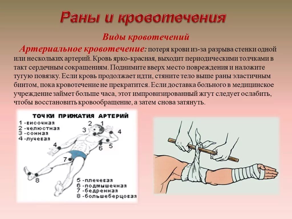 Сильная потеря крови. Артериальное кровотечение. Виды артериального кровотечения.