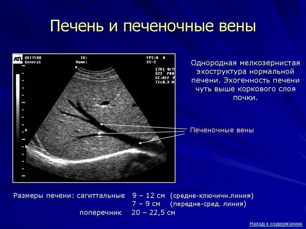 4 размера печени. Ультразвуковое исследование печени и желчного пузыря. Ультразвуковое исследование печени. Нормальная печень.. Ультразвуковые нормы печени. Нормативные показатели УЗИ печень.