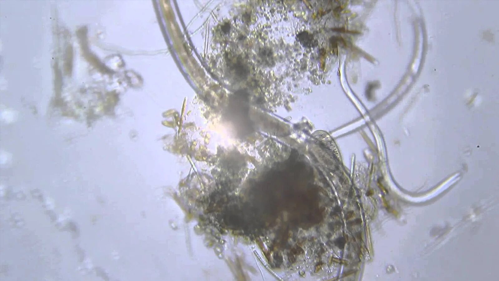 Бактерии пресной воды. Паразиты в аквариуме черви под микроскоп. Сточные воды под микроскопом. Вода под микроскопом. Микроорганизмы живущие в воде.