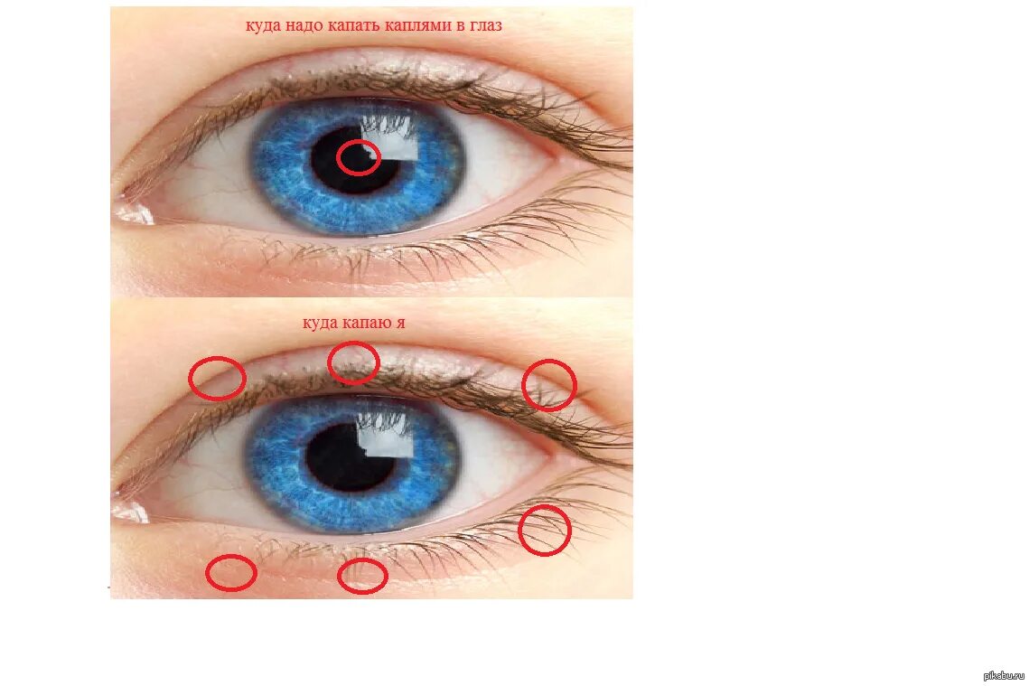 Где можно капать. Как правильно капать глазные капли. Как капать капли в глаза. Куда надо капать капли в глаза. Как капать капли в глаза самому себе.