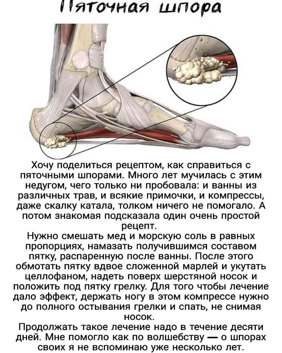 Можно наступать на пятку