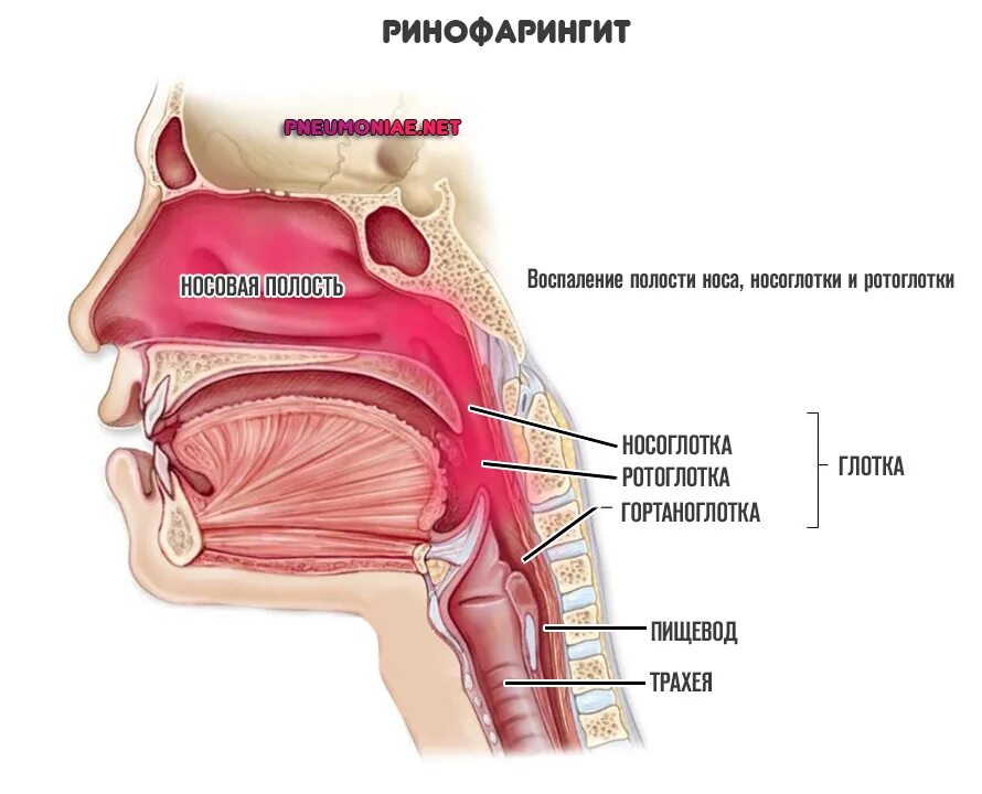 2. Ринофарингит. Острый и хронический ринофарингит. Что такое острый назофарингит