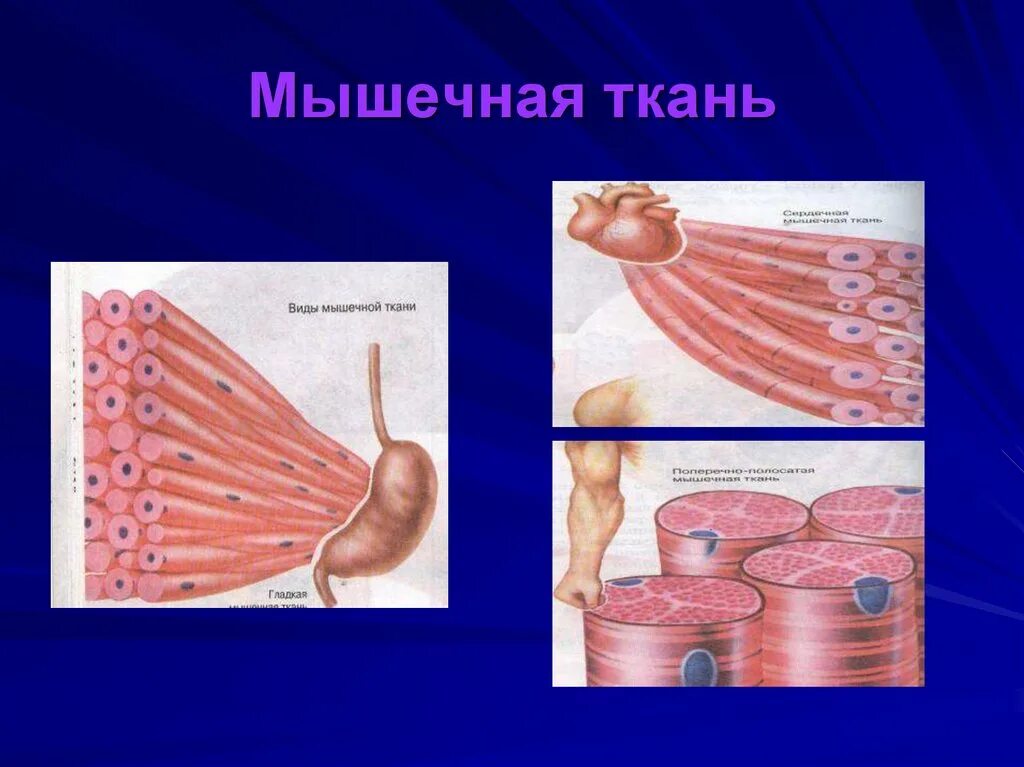 Напряжение мышечной ткани