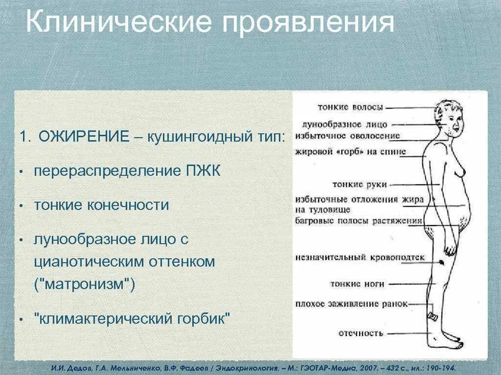 Синдром кушинга рекомендации