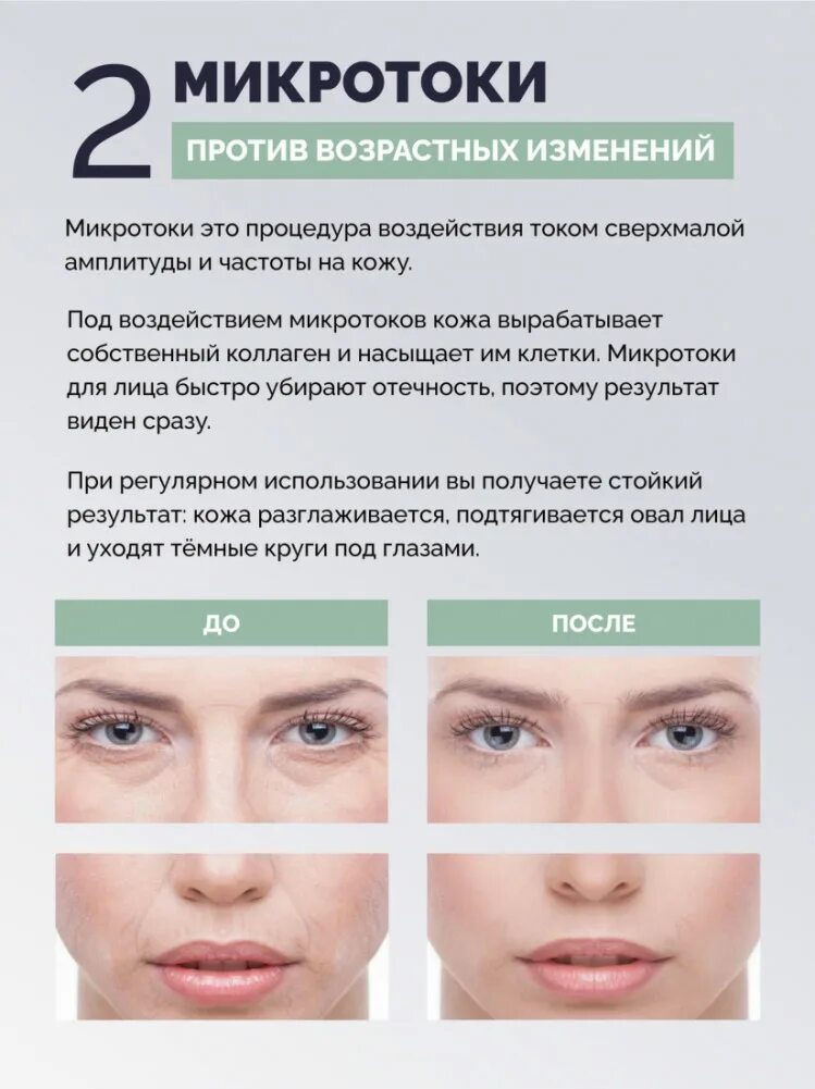 Микротоки лицо до и после фото отзывы. Rf лифтинг лица и микротоки. микротоки для лица. gess микротоки для лица. эффект от микротоков для лица.