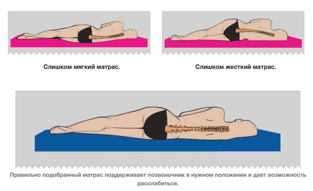 Поясница матрас. Правильный матрас для позвоночника. Правильный матрас при остеохондрозе. Жёсткий матрас для спины. Матрас при остеохондрозе позвоночника.