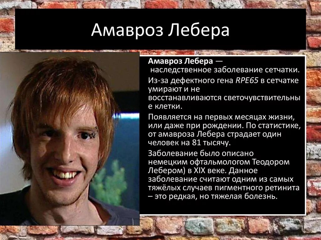 Синдром лебера тип наследования. Наследственная атрофия зрительного нерва лебера. врожденный амавроз лебера. наследственная оптическая нейропатия.