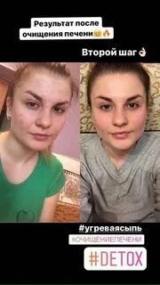 Отзывы очищения нл