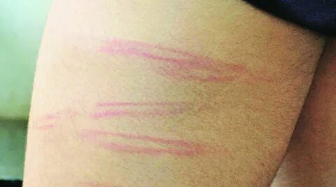 Caned il