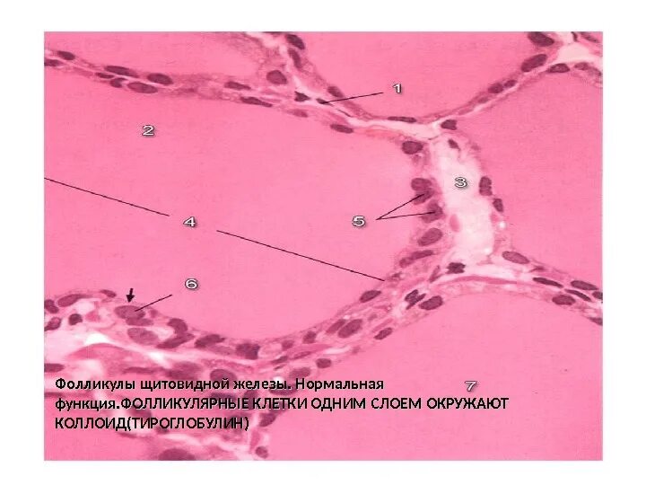 Фолликул щитовидной железы что это. Строение фолликула щитовидной железы гистология. Клетки щитовидной железы микропрепарат. Коллоид фолликулов щитовидной. Щитовидная железа собаки микропрепарат.