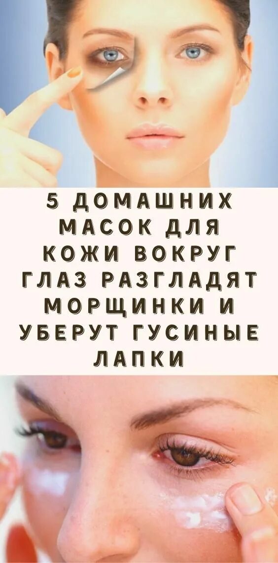 Как избавиться от гусиных. Гусиные лапки вокруг глаз. домашние маски от морщин вокруг глаз. от гусиных лапок вокруг глаз.