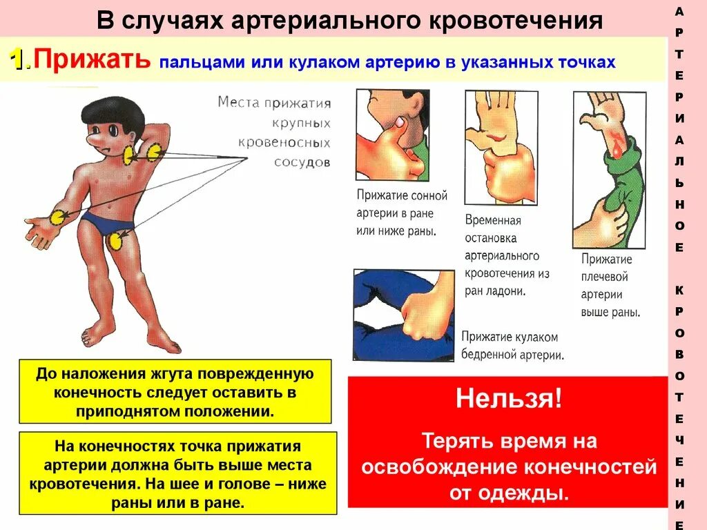 Остановить кровотечение на сонной артерии ответ тест. В случаях артериального кровотечения необходимо. Необходимо прижимать артерию в случае кровотечения. Первая помощь в случаях артериального кровотечения. В случаях артериального кровотечения на конечностях.