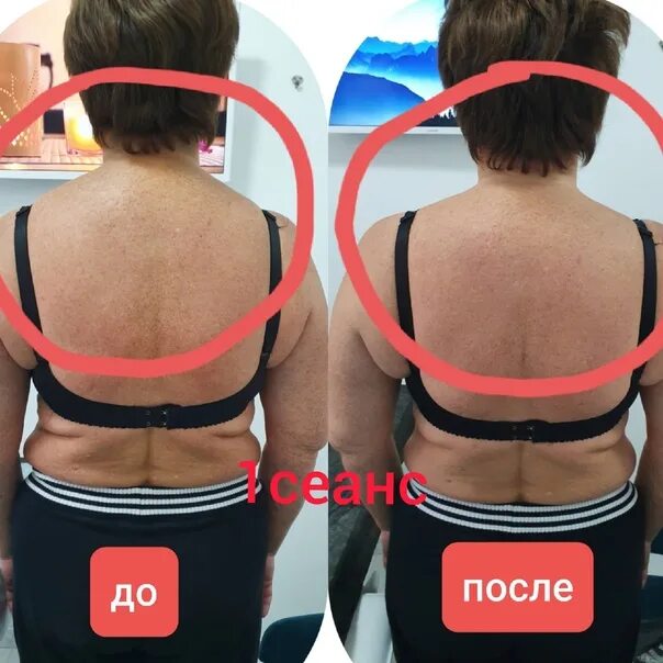 Массаж мануальная терапия. Остеопатия позвоночник. Остеопластика массаж спины. Остеопластика массаж что это. Остеопластика массаж спины.