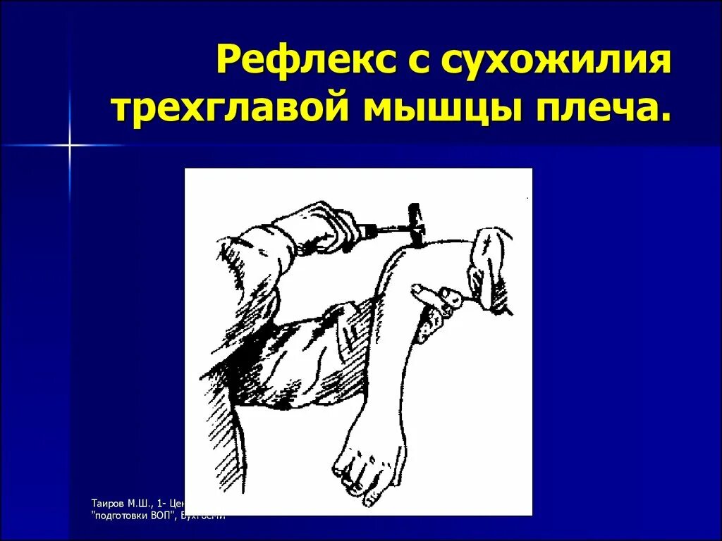 Карпо радиальный рефлекс. Стереотипная реакция организма на внешнее раздражение. Триггерная зона рвотного центра рецепторы. Исследование пястно лучевой рефлекс. Механизмы рефлекторной регуляции.