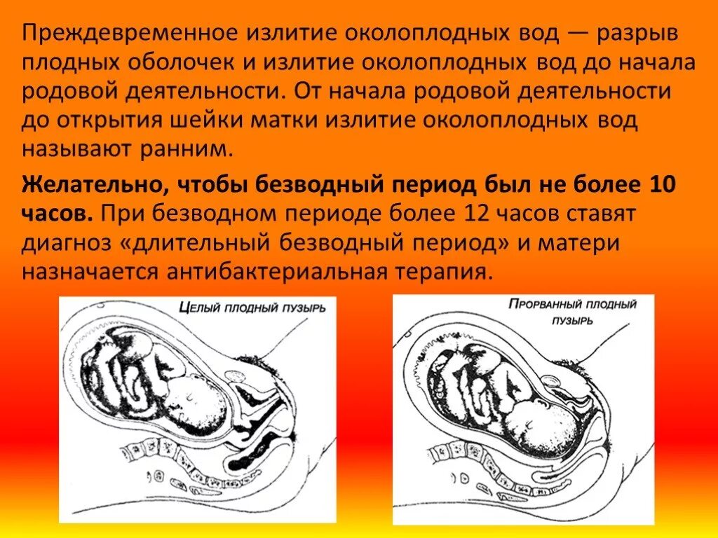 Почему околоплодные воды