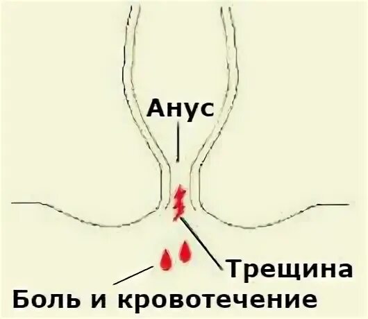 В туалет по большому с кровью: причины, возможные болезни