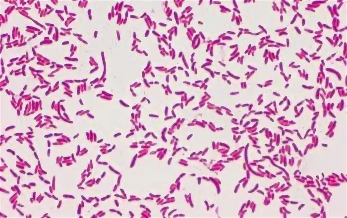 Pseudomonas Fluorescens колония. Pseudomonas aeruginosa микроскопия. Pseudomonas Fluorescens под микроскопом. Pseudomonas Fluorescens препараты.