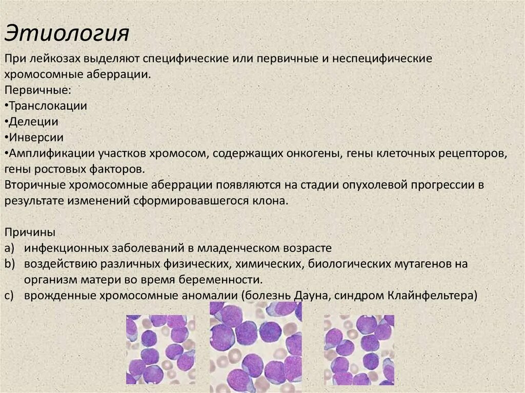 Острый лейкоз тест с ответами. Лимфобластный лейкоз этиология. Острый лимфобластный лейкоз этиология. Острый лейкоз и хронический лимфолейкоз. Острый миелобластный лейкоз картина крови этиология патогенез.