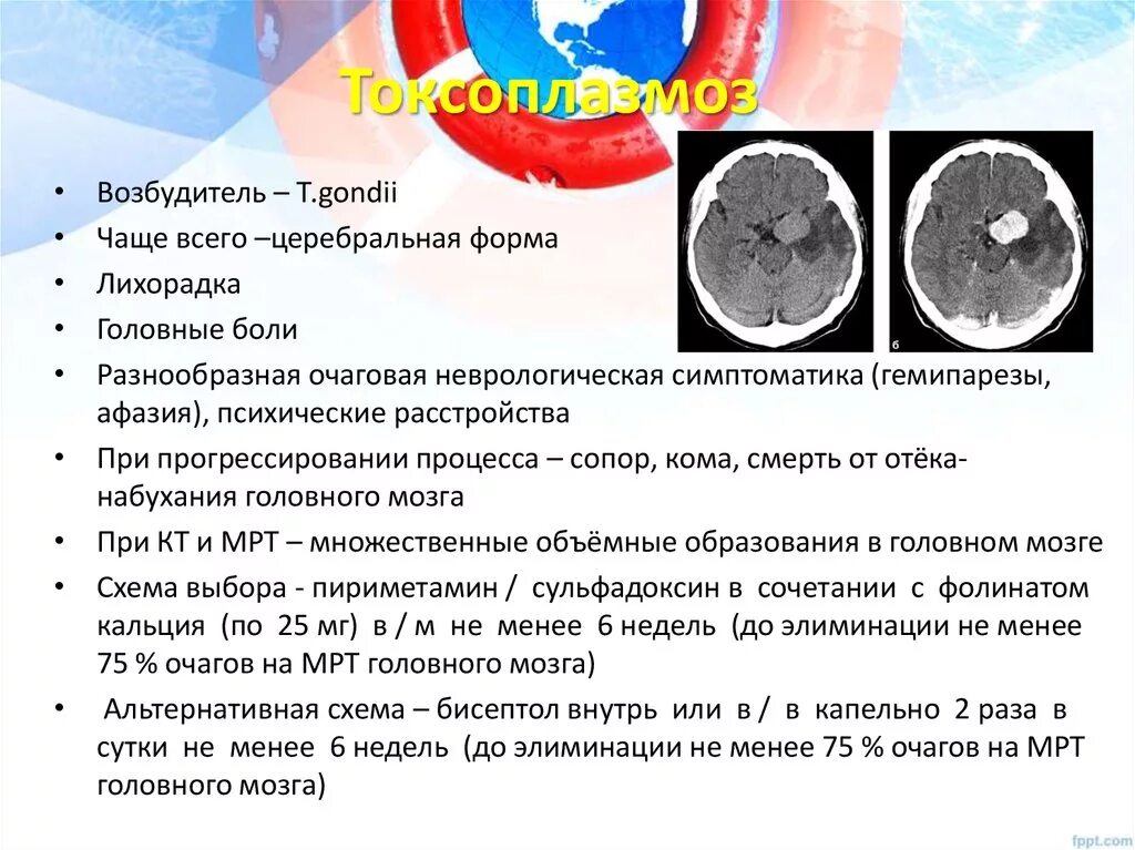 Инфекция мозга при вич. Инфекция мозга при вич