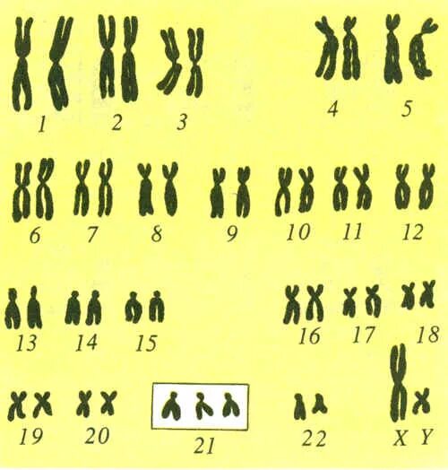 Генетический набор хромосом. Графическое изображение хромосом. Сколько хромосом у человека. Хромосомы кошки.