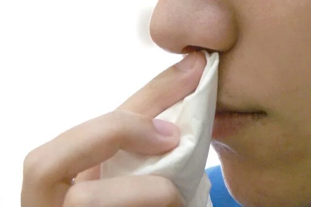 Почему течет нос без простуды. Слизистые выделения из носа. Гнойные выделения из носа.