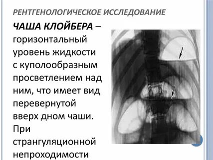 Уровень в полости