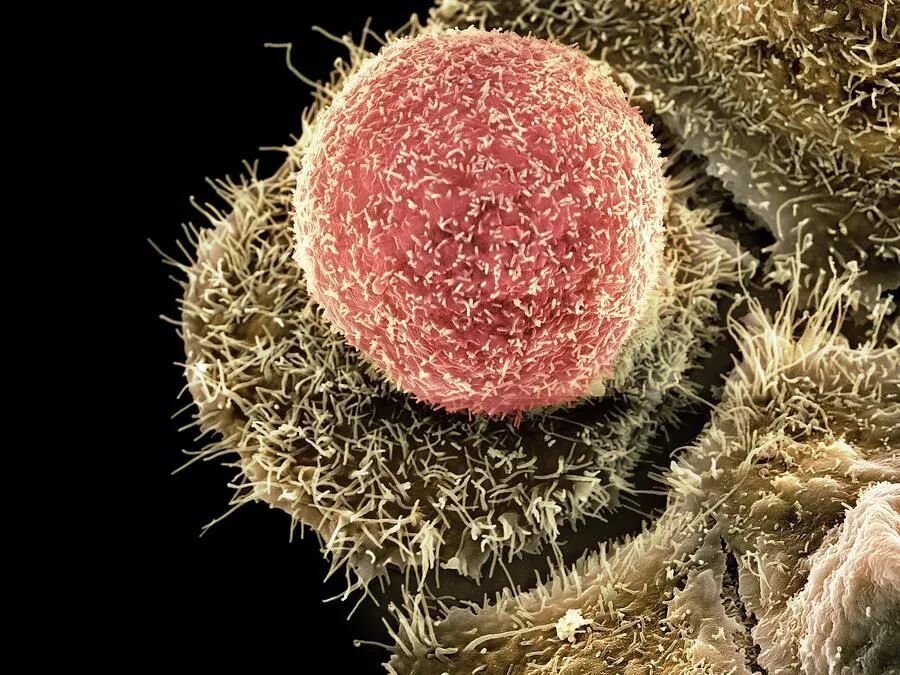 Хламидии как выглядят. Хламидия трахоматис под микроскопом. Хламидиоз трахоматис микроскоп.