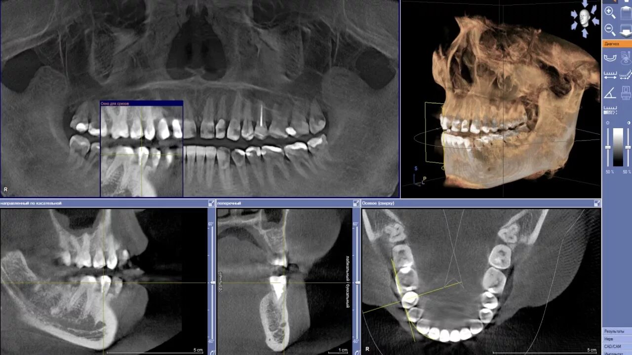 Где сделать кт зуба. Кт 3д зубочелюстной системы. Ортопантомография ВНЧС.