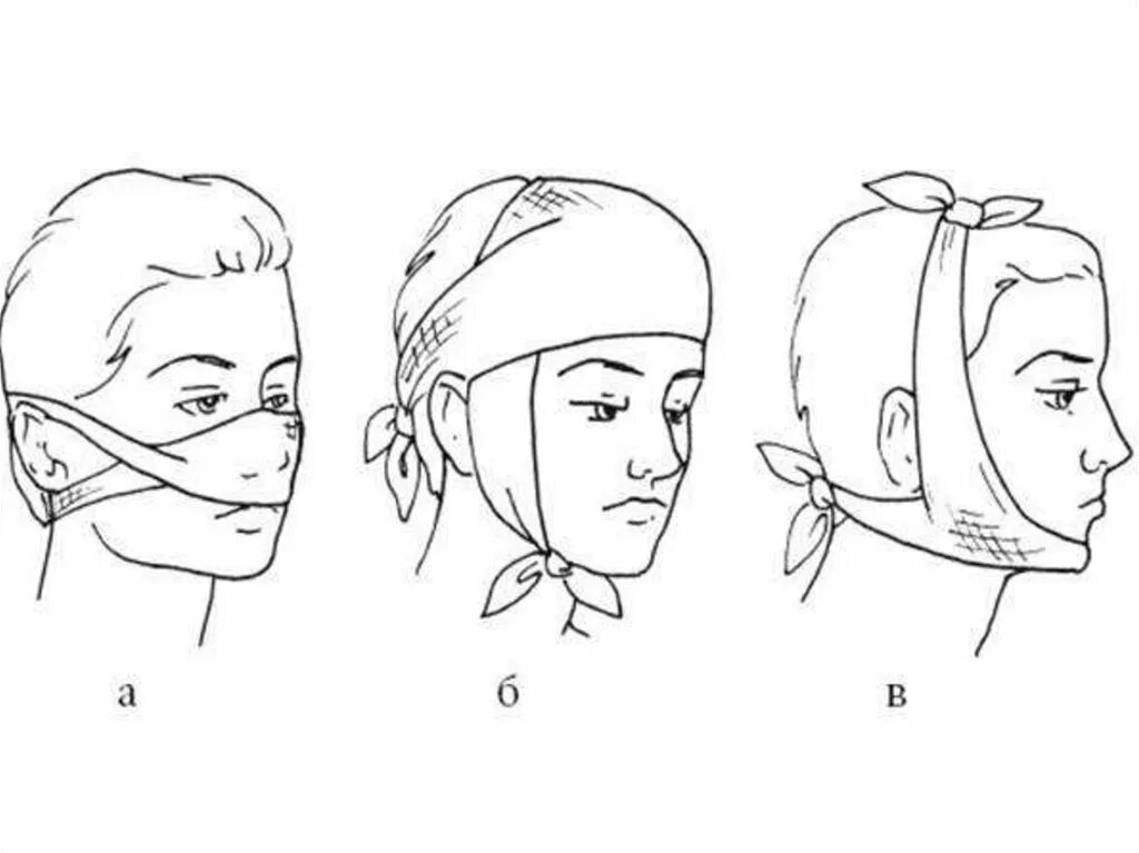 Повреждение затылка какая повязка. Наложение пращевидной повязки на нос. Пращевидная повязка на затылок. Техника наложения пращевидной повязки. Пращевидная повязка алгоритм.
