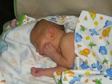 С какой желтушкой выписывают из роддома новорожденных