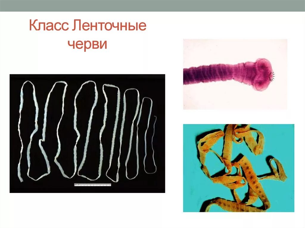 Цепень тип червей. Класс ленточные черви (Cestoda). Представители класса ленточные черви цестоды. Плоские черви ленточные черви. Плоские ленточные черви биология 7 класс.