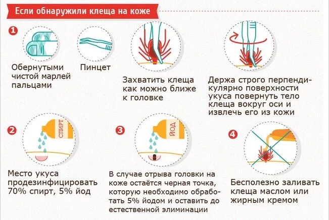 Как удалить клеща у человека самостоятельно. Как безопасно удалить клеща. Как удалить головку клеща. Как правильно вытащить клеща у человека. Как правильно достать клеща в домашних условиях.