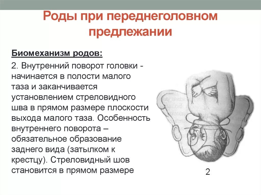 Биомеханизм переднеголовного предлежания. Переднеголовное предлежание 1 момент. Механизм родов при переднеголовном предлежании. Биомеханизм при переднеголовном предлежании. Переднеголовное предлежание