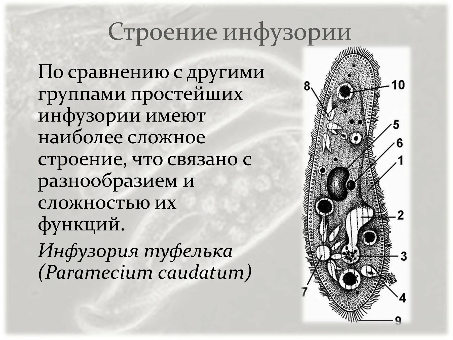 ПАРАМЕЦИЯ туфелька строение. Инфузория туфелька порошица. Инфузория туфелька макронуклеус. Пищеварительная вакуоль инфузории туфельки.