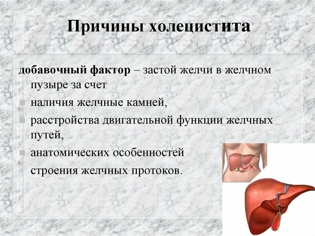 Застой в печени симптомы. Холецистит причины возникновения. Причины острого холецистита. Острый холецистит причины возникновения.