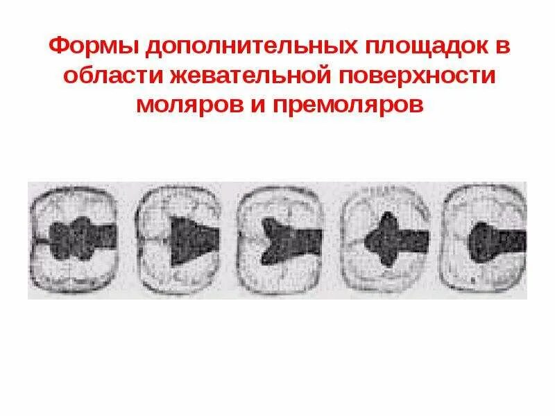 Дополнительная площадка это