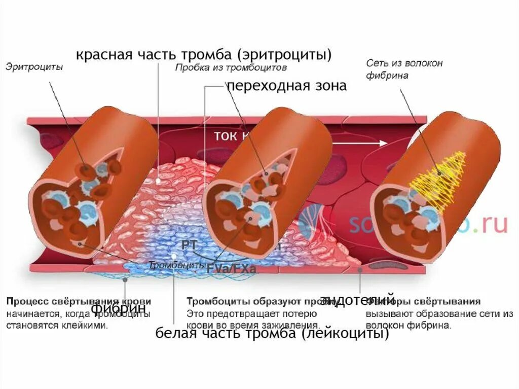 Формирование красного тромба. Строение красного тромба. Строение тромба