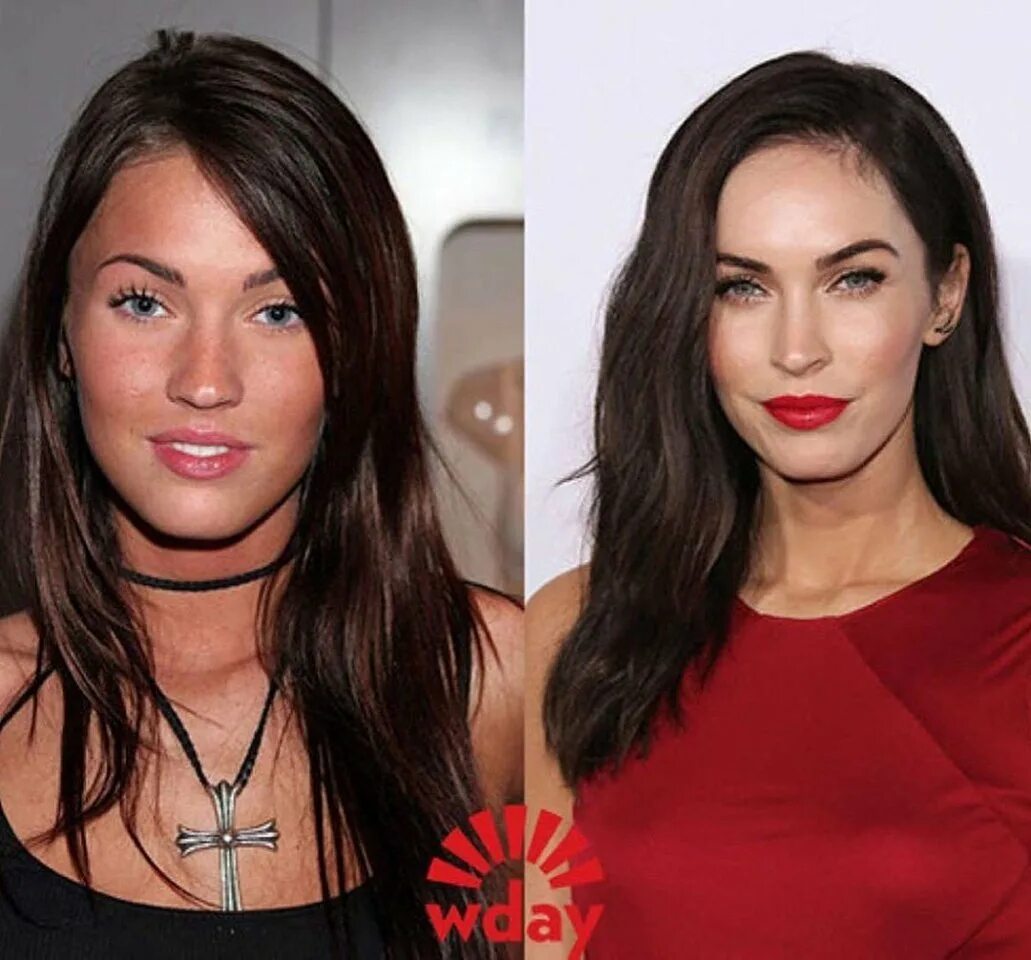 Celine centino до и после. Селин сентино до пластики. Валерия лукьянова барби до операции. Юля волкова после пластики 2020. Знаменитости после пластических операций.