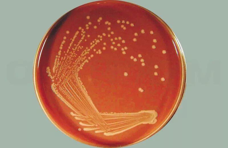 Бактерии Haemophilus influenzae. Колонии гемофильной палочки на кровяном агаре. Рост микроорганизмов на кровяном агаре. Бактерия гемофильная палочка.