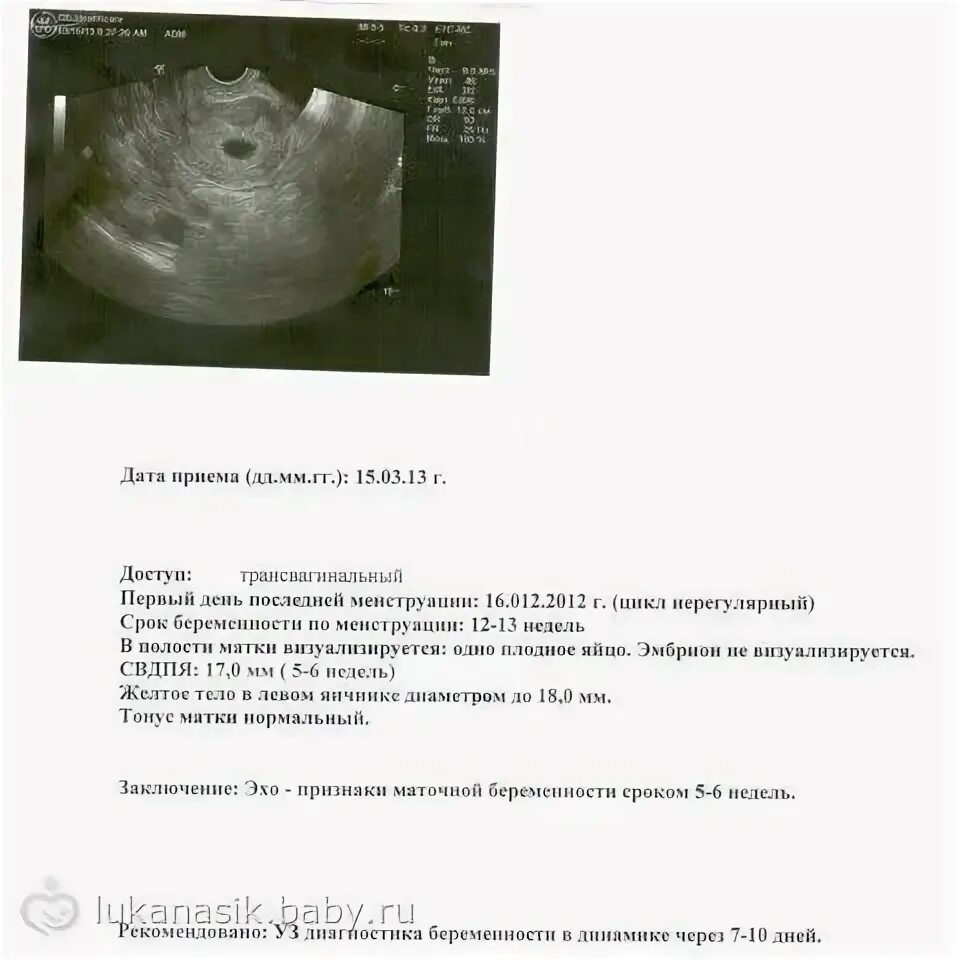 Не видно эмбриона на 6 неделе беременности. Узи 6 недель беременности описание. узи плодного яйца на 5 неделе беременности. эмбриональный срок беременности 5-6 недель. эмбрион 5 недель описание узи.