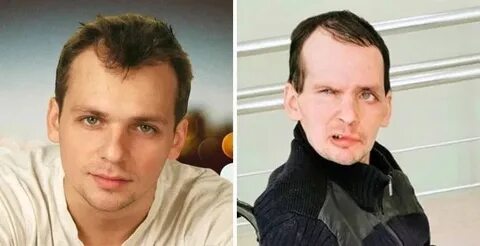 Актер умерший от инсульта
