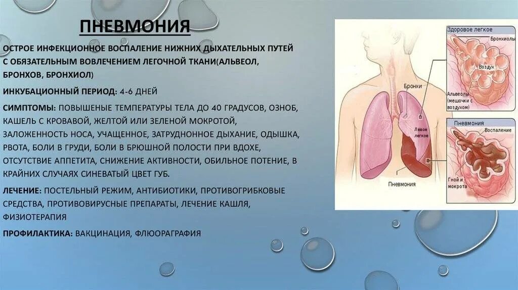 Воспаление легких без температуры признаки у взрослого. Пневмония цвет мокроты. Пневмония кашель с мокротой. Пневмония симптомы мокрота.