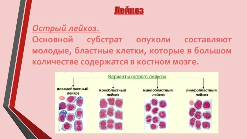 Хронический лимфолейкоз боастнвк клетки. Острый лейкоз бластные клетки. Острый миелобластный лейкоз презентация. Острый лейкоз субстрат опухоли. Опухоль клеток крови